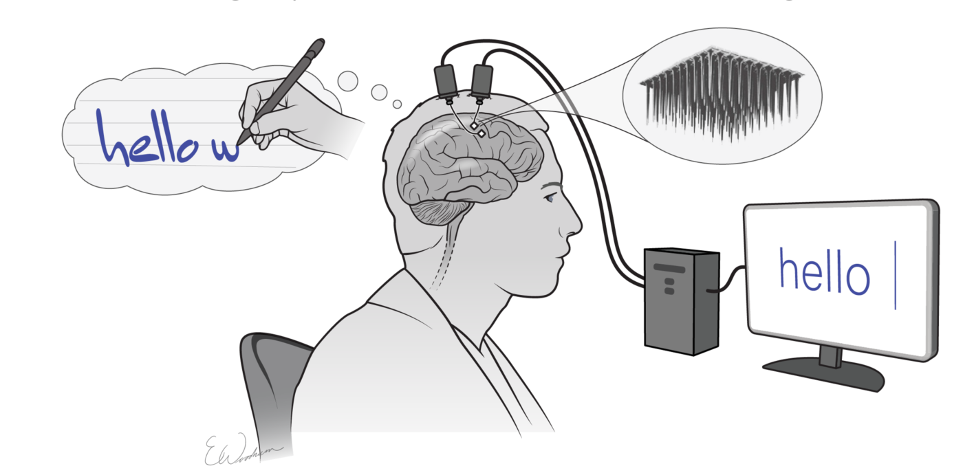 two tiny arrays of implanted electrodes relayed ...