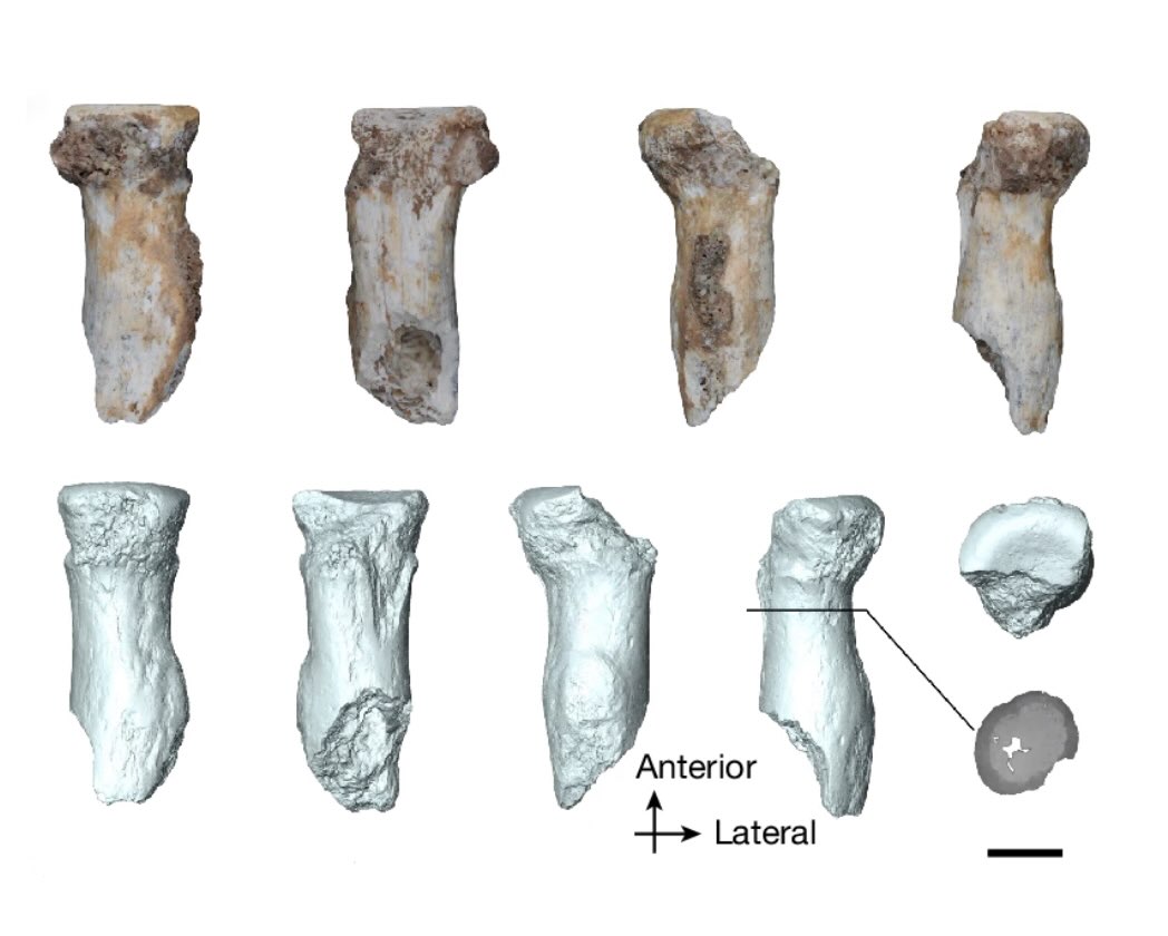 Above: Various views of the Bianfu Cave radius from layer 7 (BFD771, upper row) and its virtual reconstruction (bottom row); from left to right: anterior, posterior, medial, lateral and proximal views (Image Credit: Rao, H., et al, "Ancient proteins identify various Denisovan remains from Southwest China." Nature, 1-7. https://doi.org/10.1038/s41586-026-10976-9)